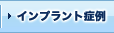 �C���v�����g�Ǘ�