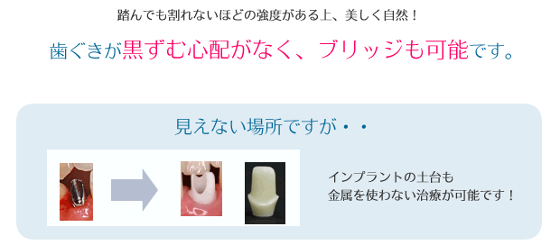 歯ぐきが黒ずむ心配がなく、ブリッジも可能です
