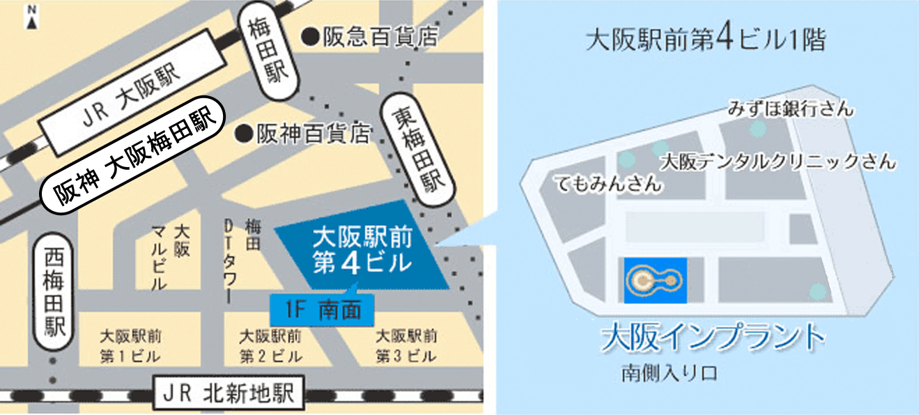 アクセス 地図 インプラントなら 大阪インプラント