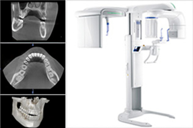 歯科用CT